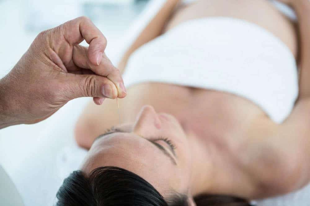 Acupuncture for Headaches and Migraines- Helps During Pregnancy