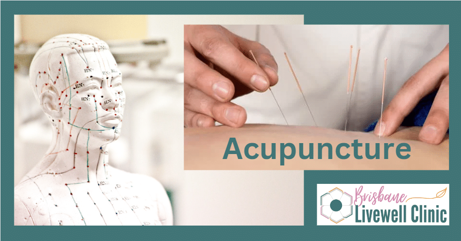 Acupuncture at Brisbane Livewell Clinic
