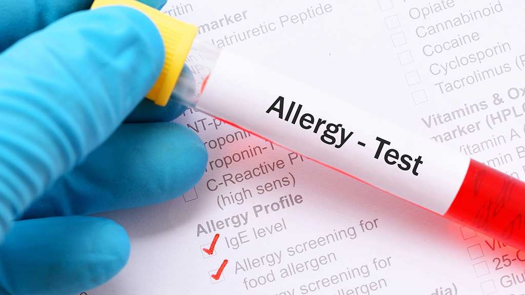 food allergy test kit
